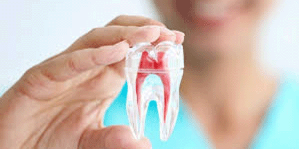 ROOT CANAL TREATMENT