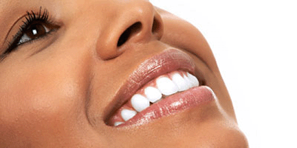 teeth whitening